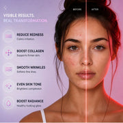 DermaLume Red Light Therapy Mask